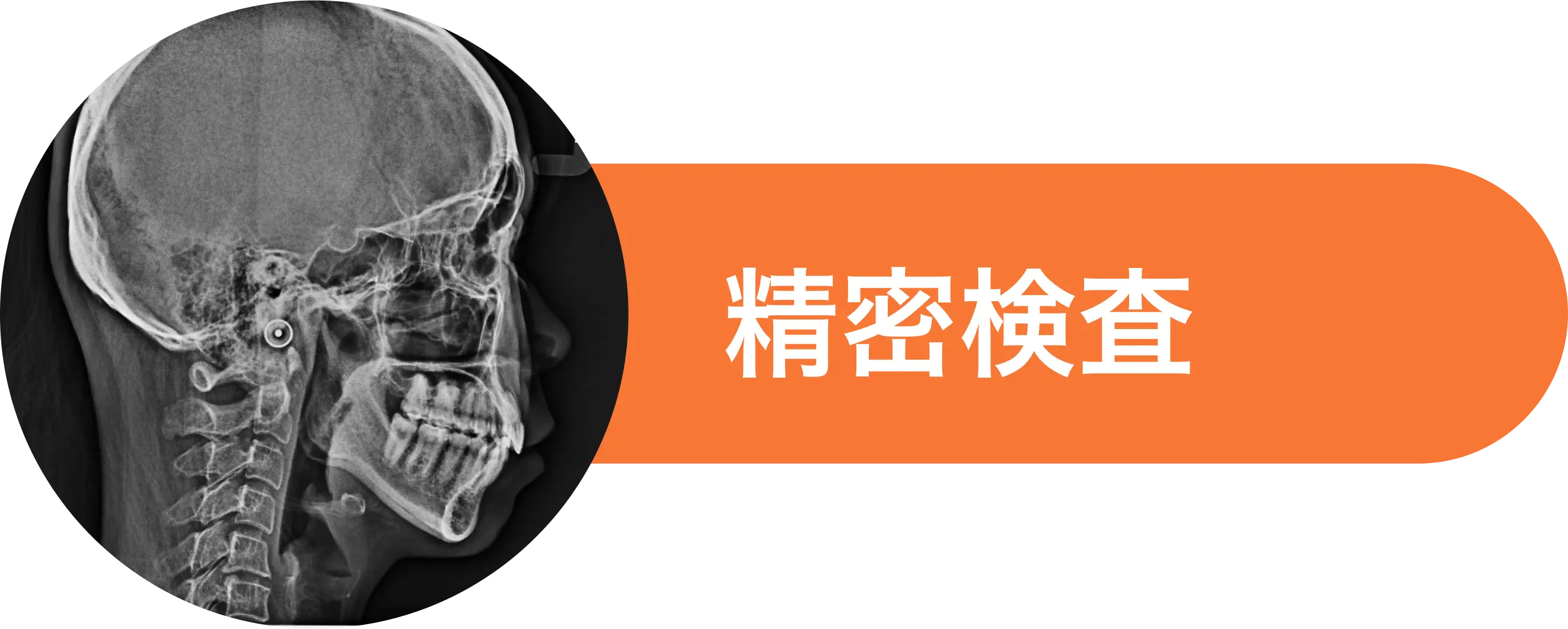 精密検査