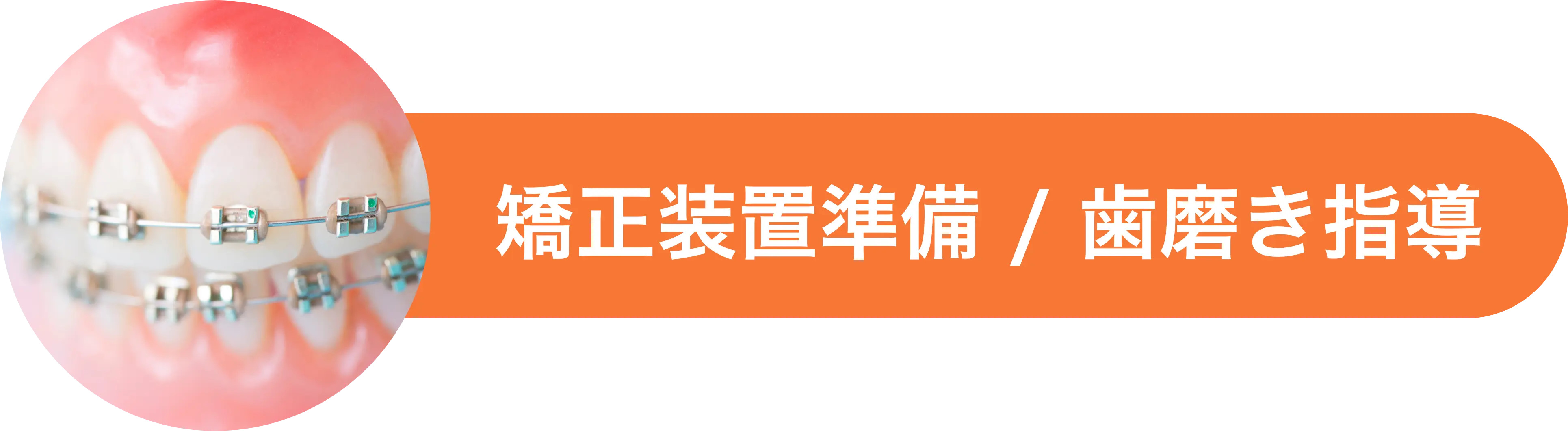 矯正装置の準備 歯磨き指導